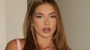 Conheça o procedimento que Virginia Fonseca fez para diminuir acne