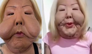 Juju do Pix: Confira o antes e depois do rosto da influenciadora